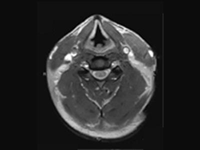 頚部（水平の断面）