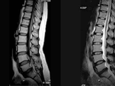 腰椎（水平の断面）